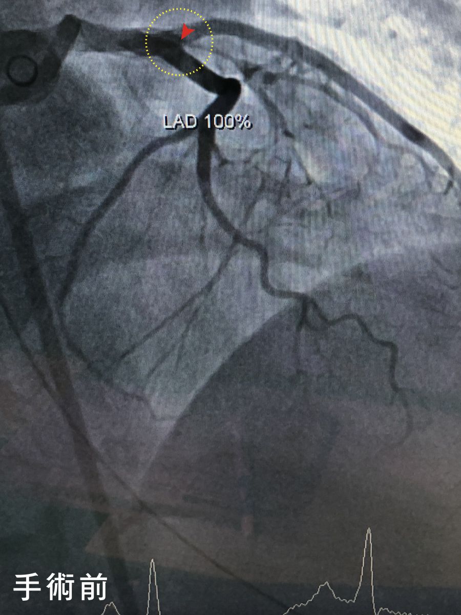 輕能量、心肌梗塞、OL、胃痛、奇蹟之星、磁能項鍊、血液循環、自律神經、三高、高血壓、高血脂