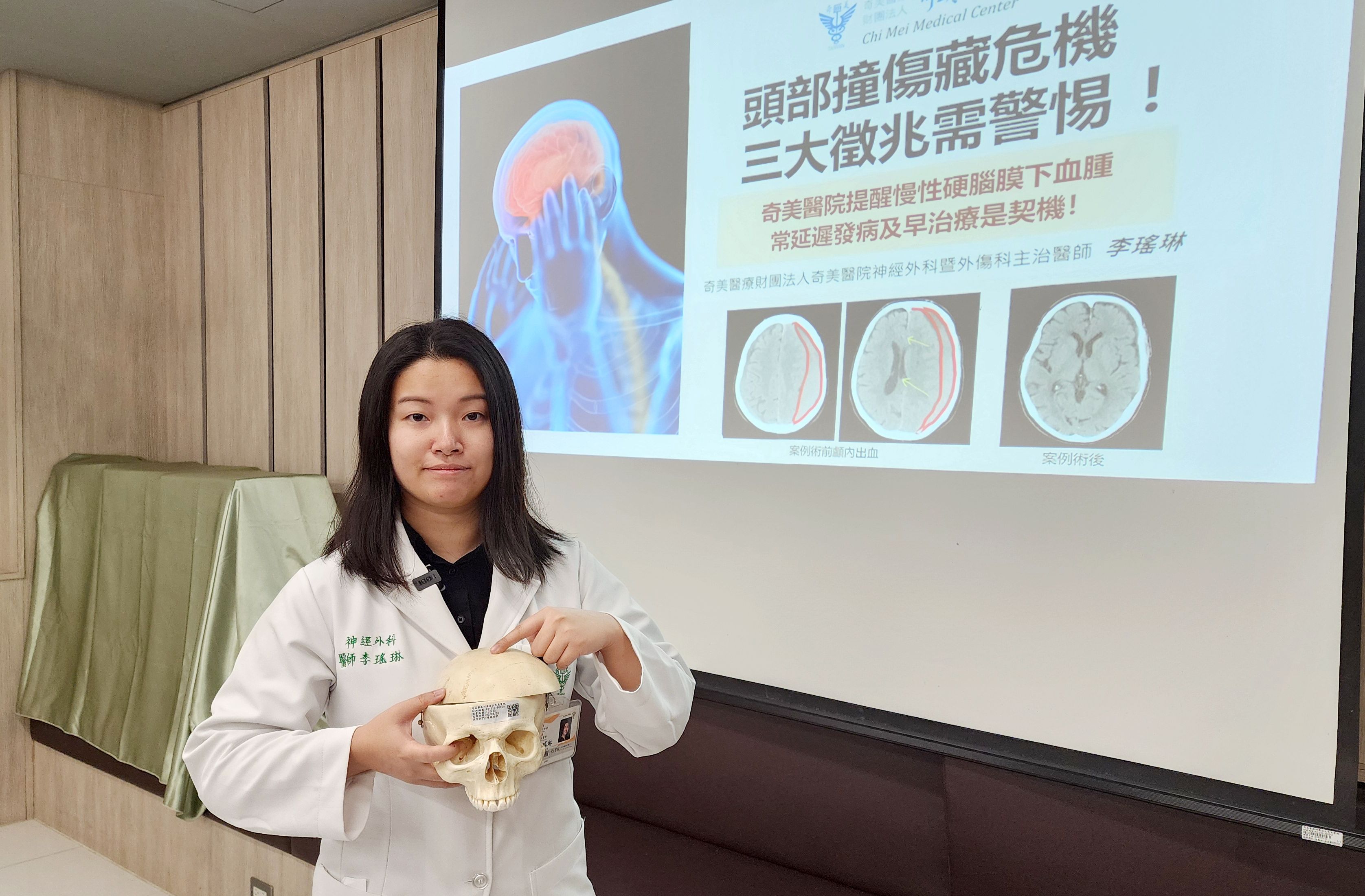 頭部撞傷藏危機   三大徵兆需警惕