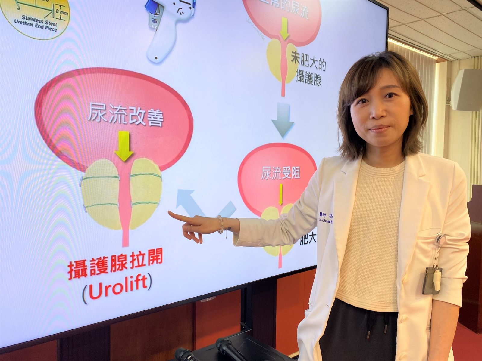 圖：臺中榮總泌尿醫學部醫師胡如娟說明，攝護腺拉開術沒有破壞攝護腺組織，屬物理方式治／臺中榮總提供