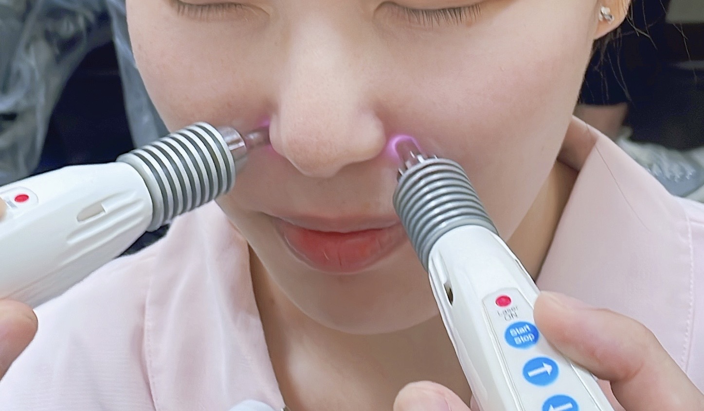 圖：雷射針灸幫助患者提升免疫力，緩解症狀／新營醫院提供