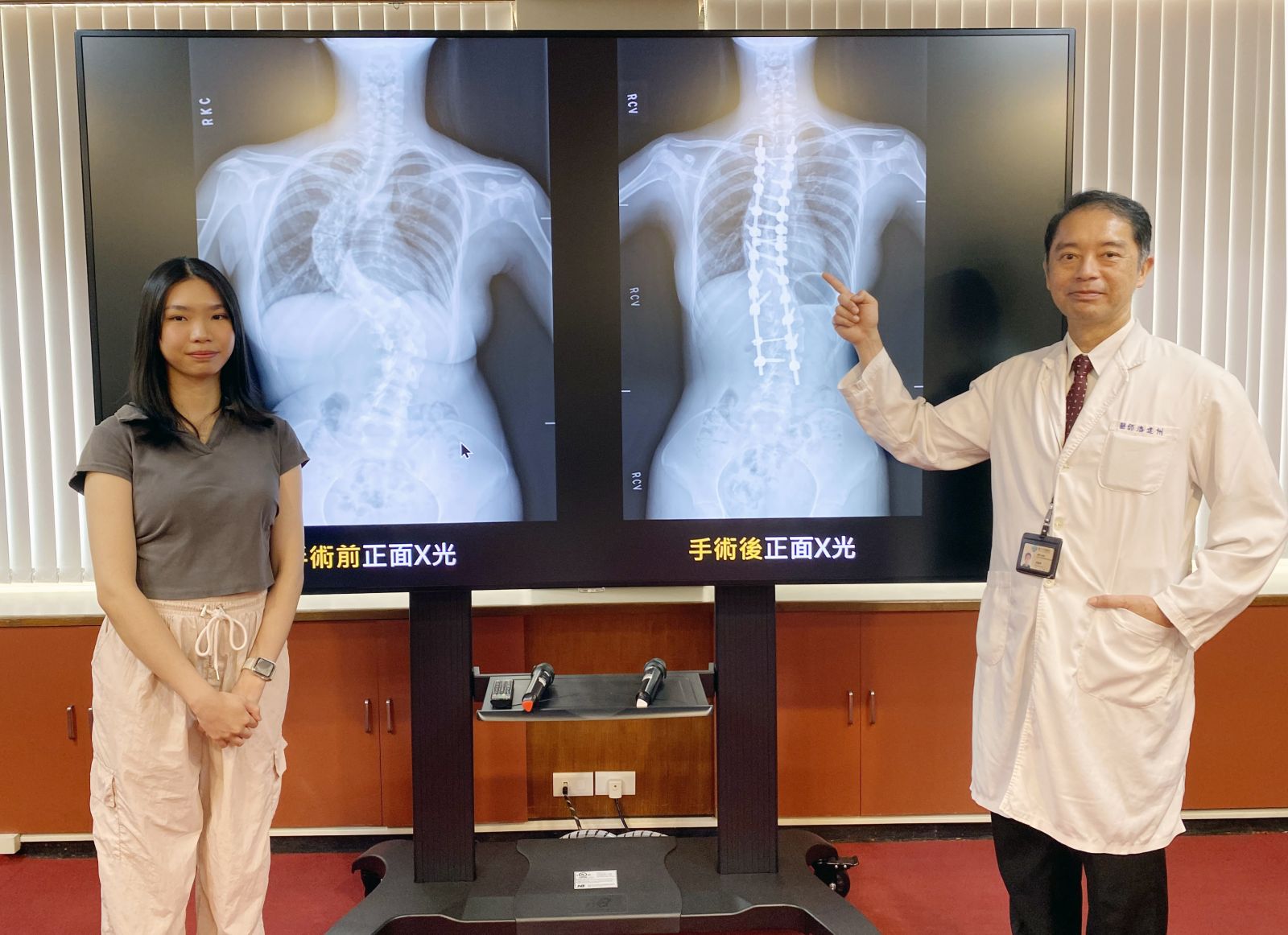 圖：黃同學(左)脊椎側彎達90度，臺中榮總骨科部脊椎外科主任潘建州(右)為她進手術矯正／台中榮總提供